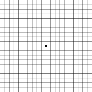 amsler-grid-calgary-retina-consultants